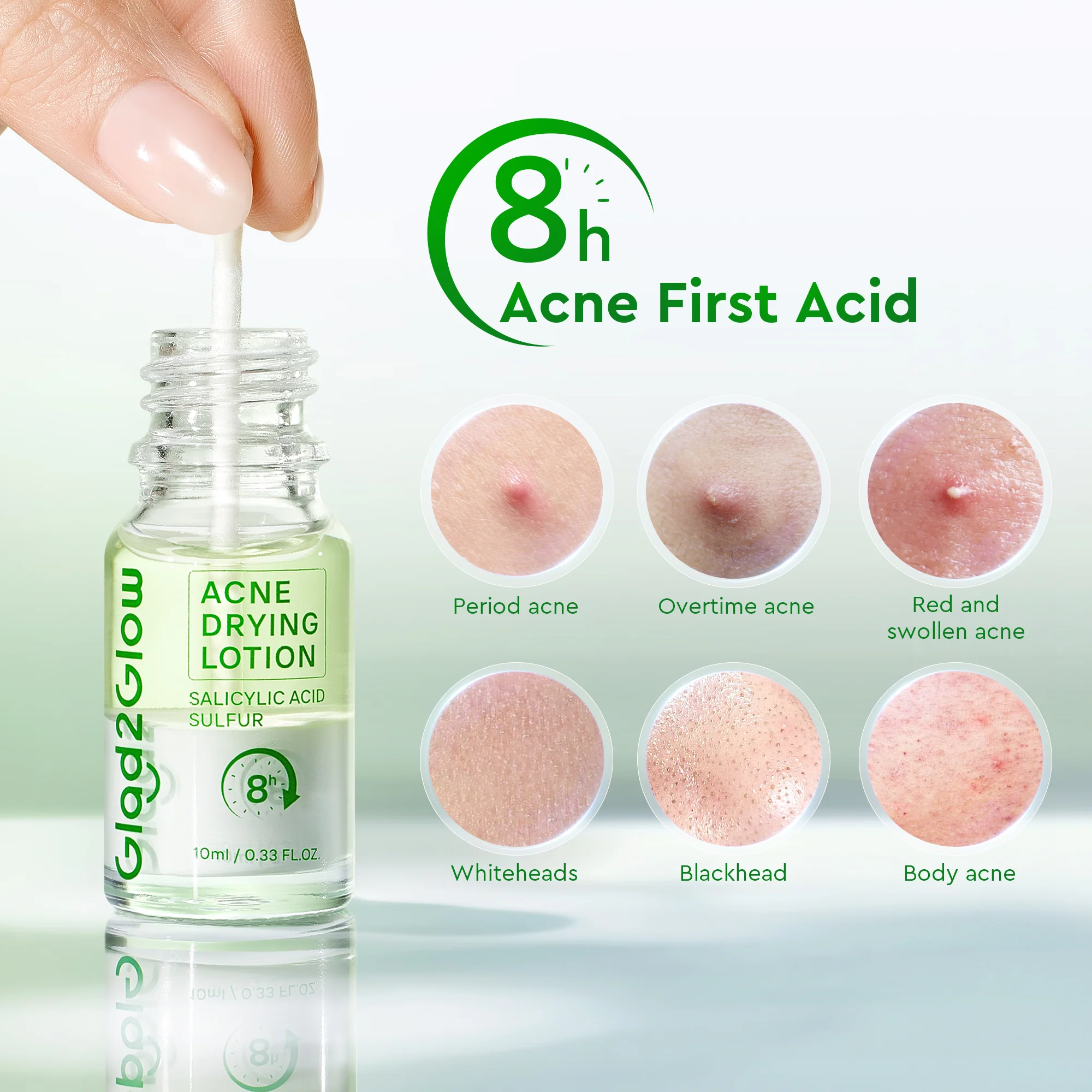 Acne Drying Lotion - Image 3