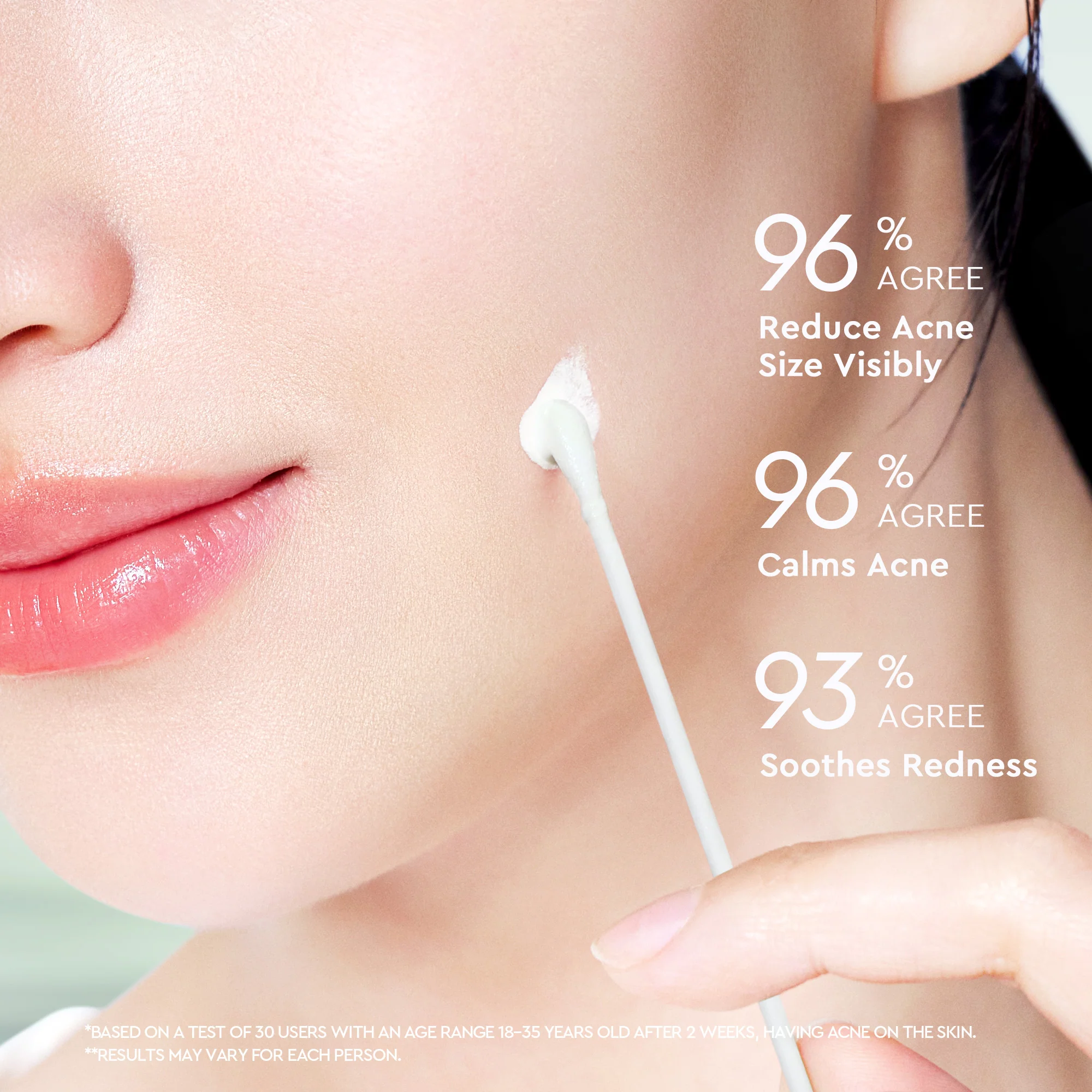 Acne Drying Lotion - Image 7