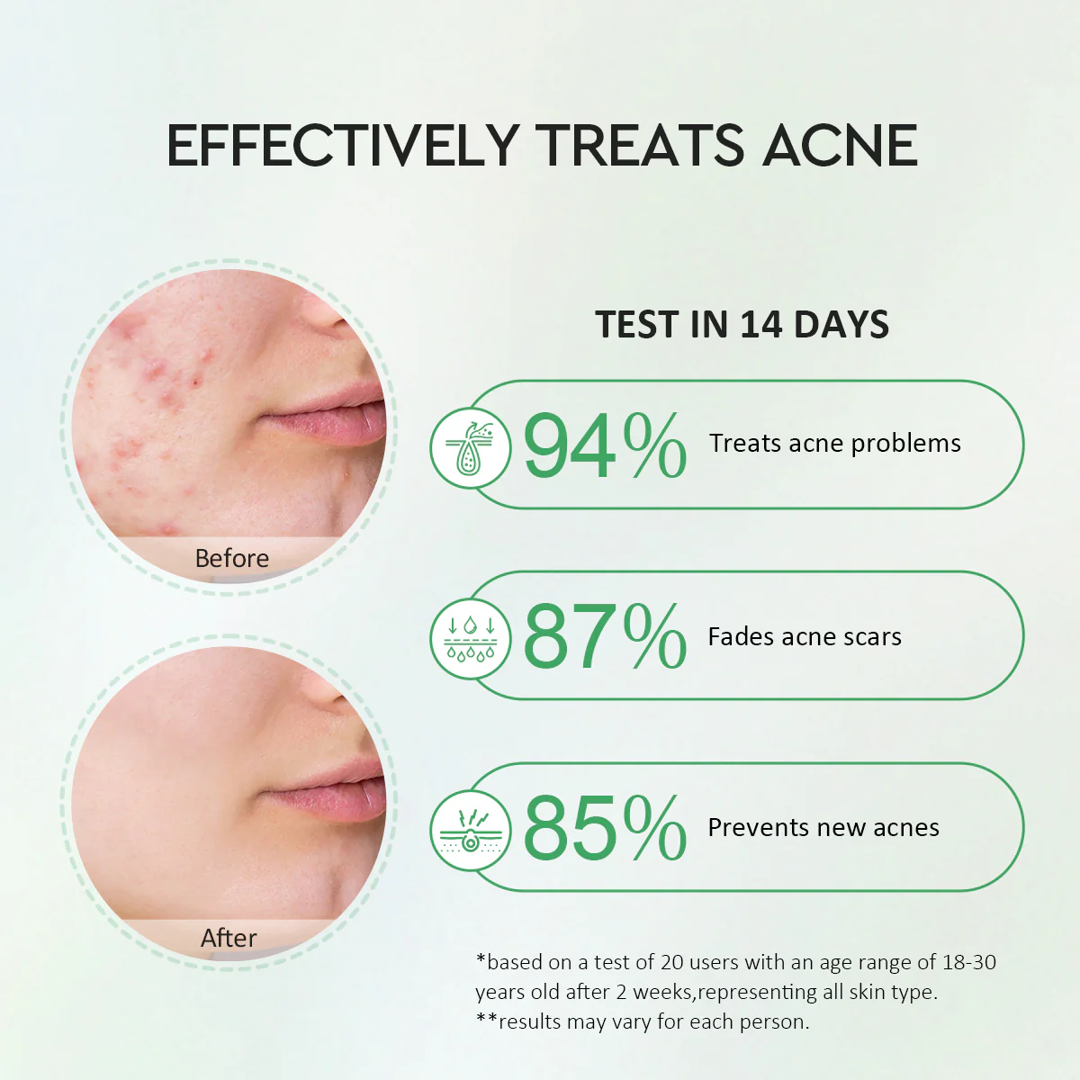 Centella 2% Salicylic Acid Power Clear Acne Serum - Image 6