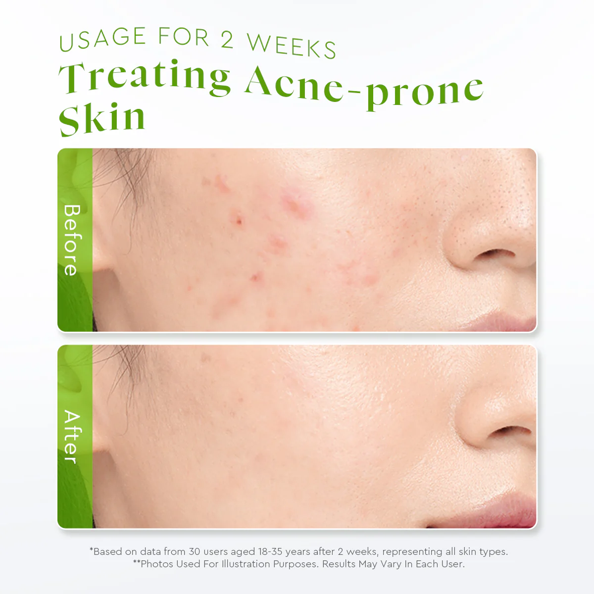 Centella Allantoin Soothing Gel Moisturizer - Image 5
