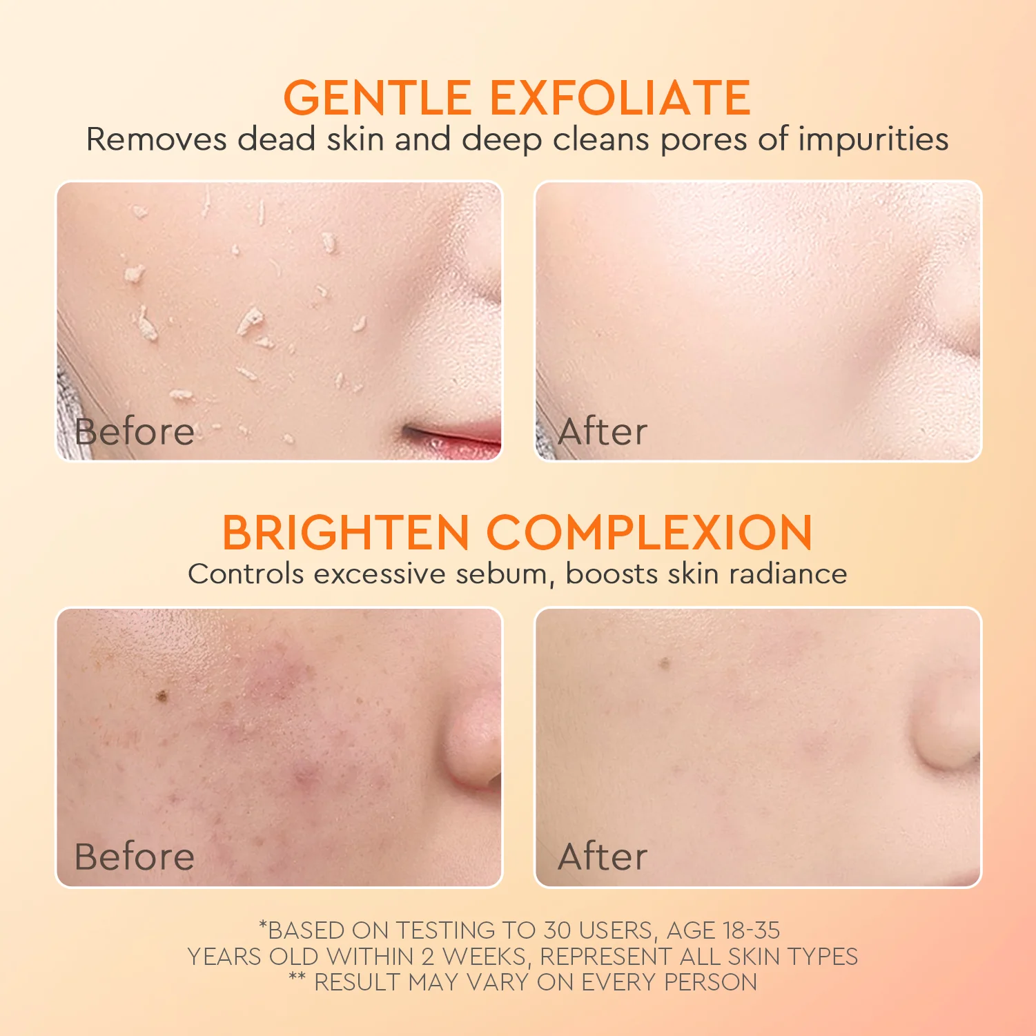 Apricot Glycolic Acid Exfo Smooth Peeling Gel - Image 6