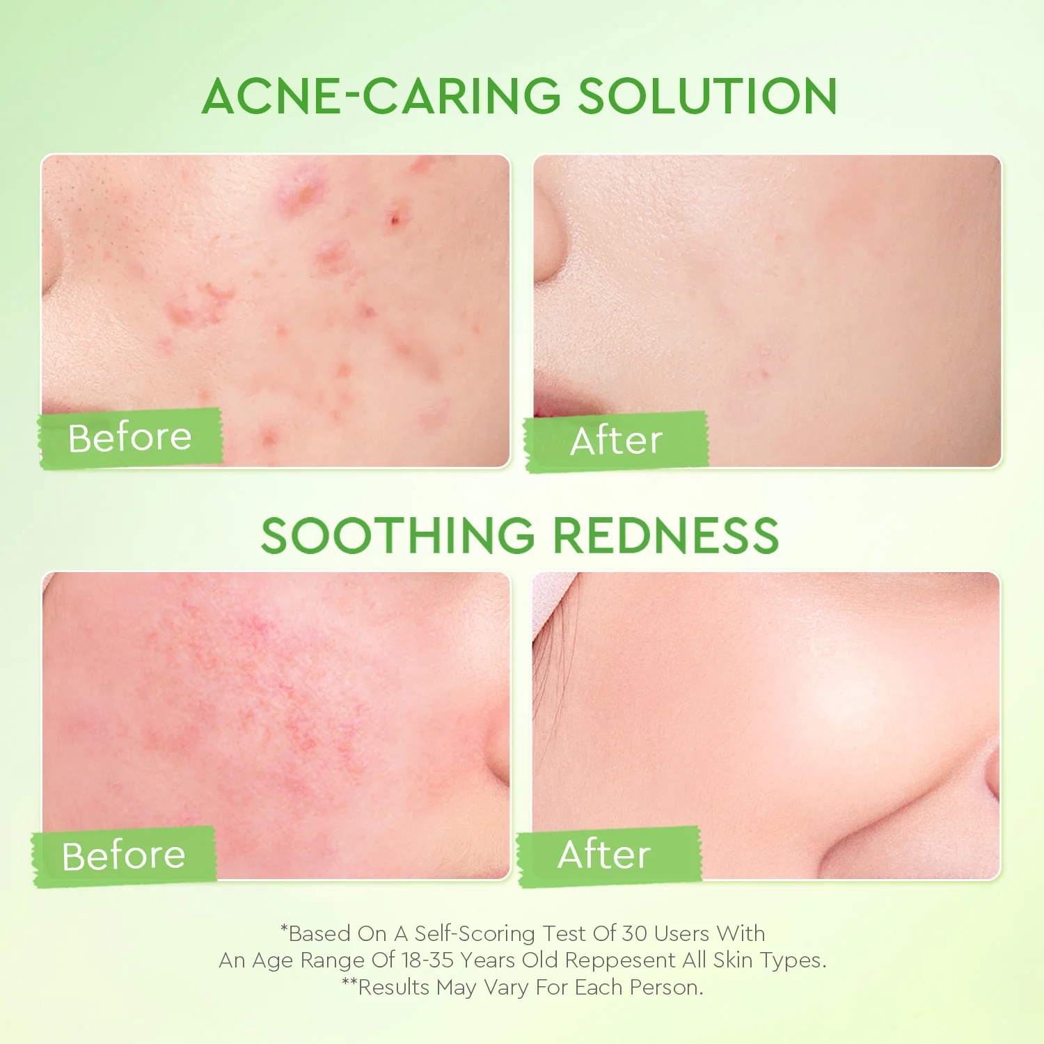 Kiwi 3D Acid Moisturizer - Image 5