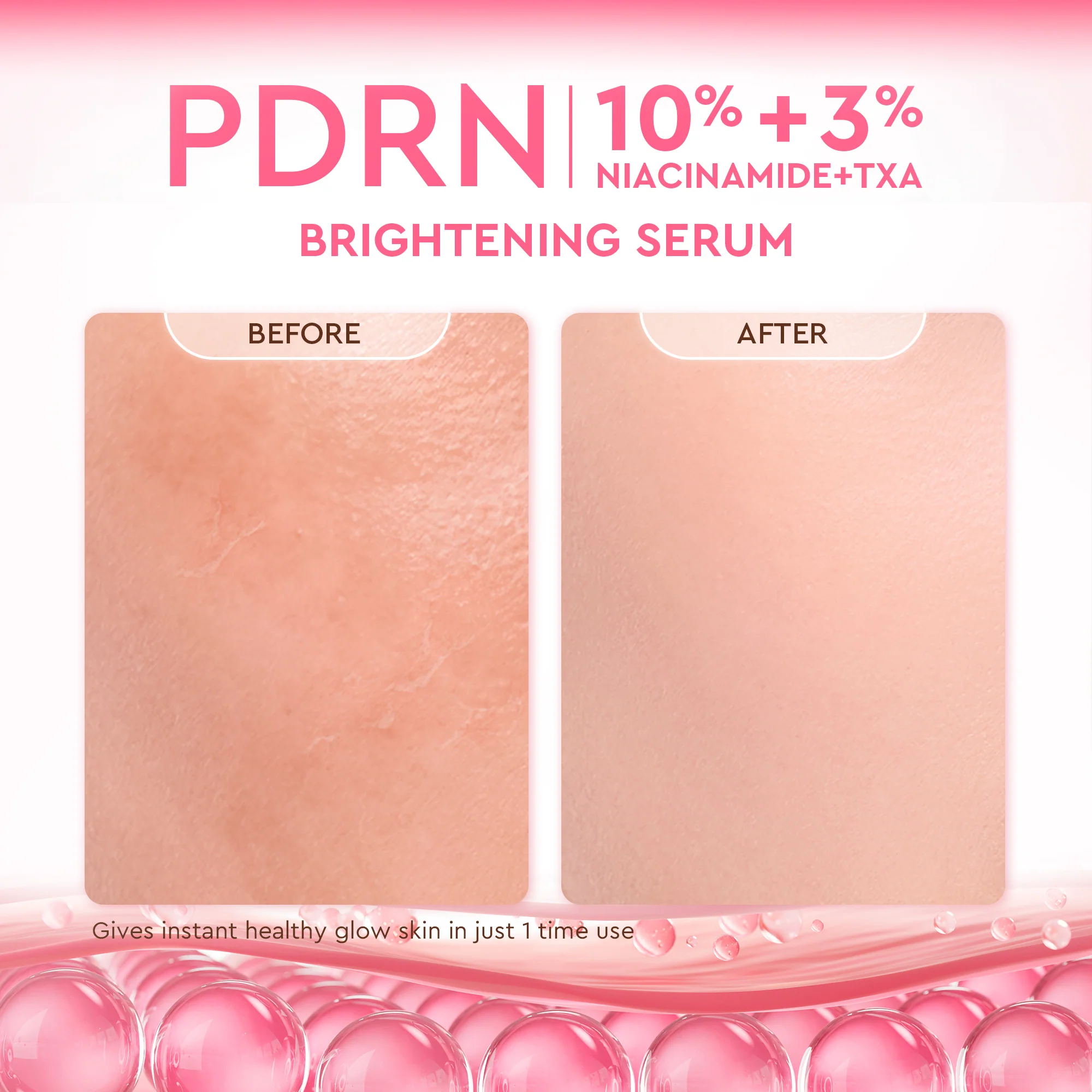 Pdrn 10% Niacinamide 3% Txa Brightening Serum - Image 9